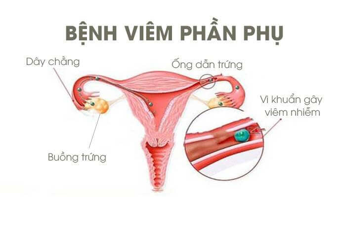 Các bệnh về viêm nhiễm phần phụ